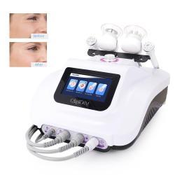 Вакуумная машина для похудения 