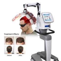 Аппарат LED PDT 655nm для лечения выпадения волос (арт. 25-19081534)