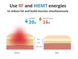Аппарат для коррекции фигуры Hi-EMT Ems RF для салонов (арт. 25-19081579)