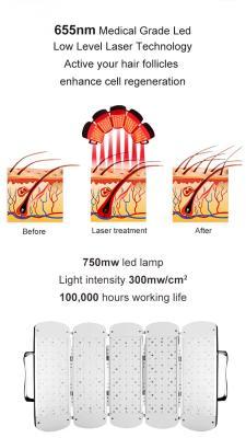 Аппарат для светотерапии Astiland 650nm для роста волос (арт. 25-19081717)